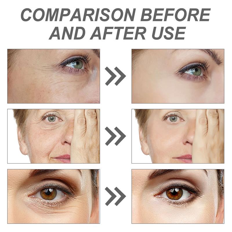 Sérum Visage au Rétinol Anti-r - The Ordinary Serum Hyaluronic Acid avis et prix
